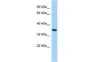 Host: Rabbit Target Name: TAS2R5 Sample Type: Fetal Lung lysates Antibody Dilution: 1.