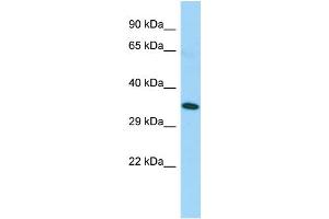 Host: Rabbit Target Name: TAS2R5 Sample Type: Fetal Lung lysates Antibody Dilution: 1. (TAS2R5 抗体  (C-Term))