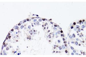 Immunohistochemistry of paraffin-embedded Mouse testis using FGF12 Polyclonal Antibody at dilution of 1:150 (40x lens). (FGF12 抗体)