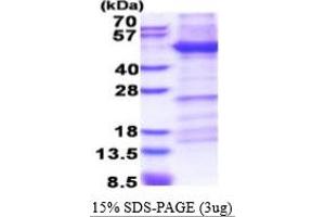 SDS-PAGE (SDS) image for Integrin beta 1 (ITGB1) (AA 21-465) protein (His tag) (ABIN5853446) (ITGB1 Protein (AA 21-465) (His tag))