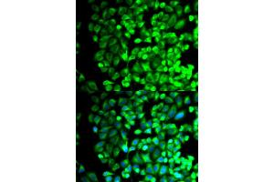 Immunofluorescence analysis of HeLa cells using TBXAS1 antibody. (TBXAS1 抗体)