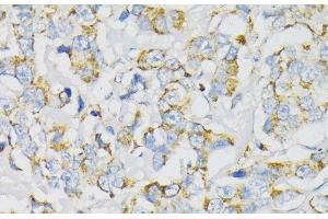 Immunohistochemistry (Paraffin-embedded Sections) (IHC (p)) image for anti-ATP Synthase, H+ Transporting, Mitochondrial F0 Complex, Subunit F6 (ATP5J) antibody (ABIN7260837)