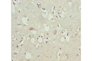 Immunohistochemistry of paraffin-embedded human brain tissue using ABIN7153645 at dilution of 1:100 (GAS2L1 抗体  (AA 130-400))