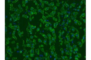 Image no. 2 for anti-Keratin 5/8 (KRT5/8) antibody (ABIN335325) (Keratin 5/8 抗体)