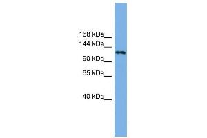 Western Blotting (WB) image for anti-Eukaryotic Translation Initiation Factor 4E Nuclear Import Factor 1 (EIF4ENIF1) (N-Term) antibody (ABIN631810)