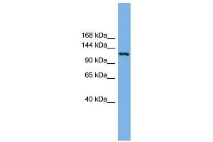 EIF4ENIF1 antibody used at 1 ug/ml to detect target protein. (EIF4ENIF1 抗体  (N-Term))