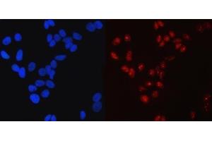 IF analysis of SP1 using anti-SP1 antibody (ABIN7601559). (SP1 抗体  (AA 384-603))