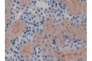 Detection of ErbB3 in Mouse Kidney Tissue using Polyclonal Antibody to V-Erb B2 Erythroblastic Leukemia Viral Oncogene Homolog 3 (ErbB3) (ERBB3 抗体  (AA 707-964))
