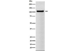 Western blot analysis of BRD2 expression in NCCIT cell lysate.