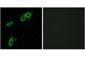Immunofluorescence analysis of LOVO cells, using GPR75 Antibody. (GPR75 抗体  (AA 381-430))