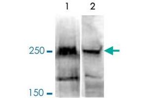 Western Blot analysis of (1) 150 ug nuclear extract of NIH3T3 cells, and (2) 150 ug nuclear extract of HeLa cells. (BAZ2A 抗体)