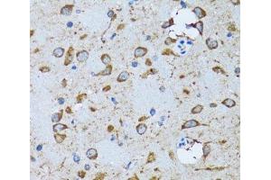 Immunohistochemistry of paraffin-embedded Mouse brain using PDP1 Polyclonal Antibody at dilution of 1:100 (40x lens). (PDP 抗体)