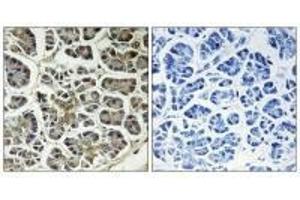 Immunohistochemistry analysis of paraffin-embedded human pancreas tissue using ATP5G2 antibody. (ATP5G2 抗体)