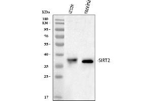 Western blot analysis of SIRT2 using anti-SIRT2 antibody (ABIN3043924). (SIRT2 抗体  (Middle Region))