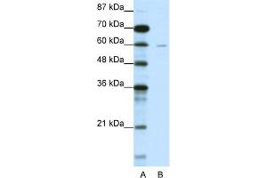 WB Suggested Anti-DCP1A Antibody Titration:  1. (DCP1A 抗体  (N-Term))