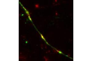 Image no. 3 for anti-TEV (Cut Protease Site) antibody (ABIN1742525) (TEV (Cut Protease Site) 抗体)
