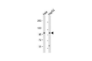 All lanes : Anti-NU Antibody (N-term) at 1:2000 dilution Lane 1: Hela whole cell lysate Lane 2: HepG2 whole cell lysate Lysates/proteins at 20 μg per lane. (NUP210 抗体  (N-Term))