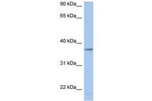 Image no. 1 for anti-Lactate Dehydrogenase A-Like 6B (LDHAL6B) (AA 251-300) antibody (ABIN6743763) (LDHAL6B 抗体  (AA 251-300))
