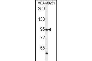 Western blot analysis in MDA-MB231 cell line lysates (35ug/lane). (FTSJ3 抗体  (AA 616-646))