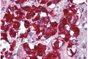 Immunohistochemistry (Paraffin-embedded Sections) (IHC (p)) image for anti-Guanine Nucleotide Binding Protein (G Protein), beta Polypeptide 2-Like 1 (GNB2L1) (C-Term) antibody (ABIN6736725)