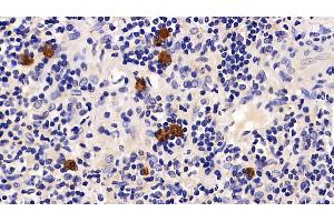 Immunohistochemistry (IHC) image for anti-Programmed Cell Death 1 (PDCD1) (AA 41-132) antibody (ABIN7440431)