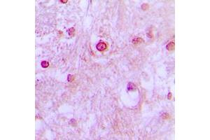 Immunohistochemical analysis of CDK10 staining in human brain formalin fixed paraffin embedded tissue section. (CDK10 抗体  (Center))
