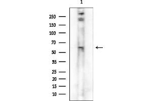 Western blot analysis of lysates from 293 cells(starvation treatment), using Phospho-Chk2 (Thr68) Antibody.