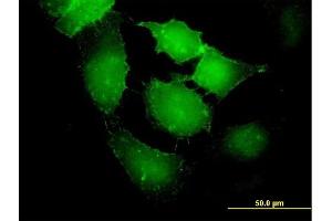 Immunofluorescence of purified MaxPab antibody to EPB41L2 on HeLa cell. (EPB41L2 抗体  (AA 1-633))
