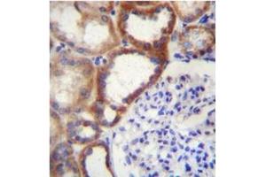 Formalin fixed and paraffin embedded human kidney tissue stained with STARD4 Antibody (N-term) Cat. (STARD4 抗体  (N-Term))