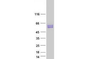 Western Blotting (WB) image for B-Cell CLL/lymphoma 3 (BCL3) protein (Myc-DYKDDDDK Tag) (ABIN2715203)