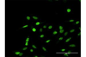 Immunofluorescence of purified MaxPab antibody to RPA1 on HeLa cell. (RPA1 抗体  (AA 1-616))