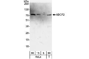 Western Blotting (WB) image for anti-ATP-Binding Cassette, Sub-Family F (GCN20), Member 2 (ABCF2) (AA 573-623) antibody (ABIN7454542)