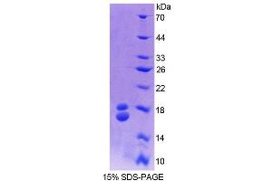 SDS-PAGE analysis of Cow RBP1 Protein.