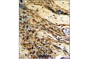Formalin-fixed and paraffin-embedded human placenta with MGMT Antibody (C-term), which was peroxidase-conjugated to the secondary antibody, followed by DAB staining. (MGMT 抗体  (C-Term))