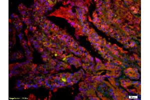 Formalin-fixed and paraffin embedded rat colon labeled with Anti-CD8 alpha Polyclonal Antibody, Unconjugated (ABIN1387948) at 1:200 followed by secondary antibody was Goat Anti-Rabbit IgG, Cy3 conjugated used at 1:200 dilution for 40 minutes at 37°C. (CD8 alpha 抗体  (AA 51-150))