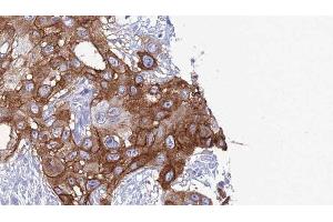 Immunohistochemistry (IHC) image for anti-Integrin, alpha X (Complement Component 3 Receptor 4 Subunit) (ITGAX) (N-Term) antibody (ABIN6260570)