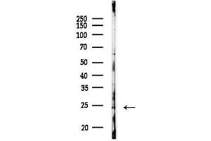 anti-RAB17, Member RAS Oncogene Family (RAB17) (Internal Region) antibody