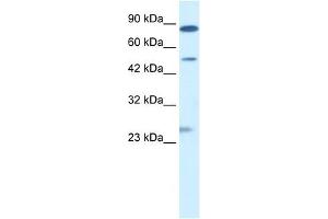 CLIC6 antibody used at 0. (CLIC6 抗体  (Middle Region))