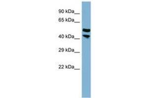 anti-PRR5L / FLJ14213 (AA 251-300) antibody