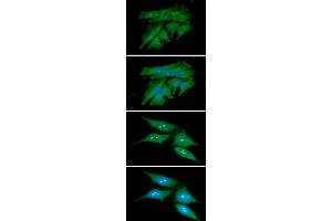 ICC/IF analysis of PDCL3 in HeLa cells line, stained with DAPI (Blue) for nucleus staining and monoclonal anti-human PDCL3 antibody (1:100) with goat anti-mouse IgG-Alexa fluor 488 conjugate (Green). (PDCL3 抗体  (AA 1-239))