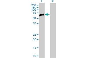 Western Blot analysis of TNFRSF1B expression in transfected 293T cell line by TNFRSF1B MaxPab polyclonal antibody. (TNFRSF1B 抗体  (AA 1-461))