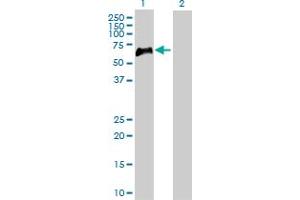 Western Blotting (WB) image for anti-Tumor Necrosis Factor Receptor Superfamily, Member 1B (TNFRSF1B) (AA 1-461) antibody (ABIN521020)