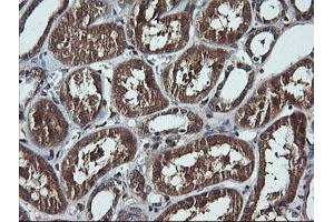 Image no. 2 for anti-DEAD (Asp-Glu-Ala-Asp) Box Polypeptide 58 (DDX58) antibody (ABIN1500708) (DDX58 抗体)