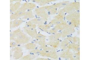 Immunohistochemistry of paraffin-embedded Mouse heart using CXCR3 Polyclonal Antibody at dilution of 1:100 (40x lens). (CXCR3 抗体)