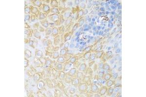 Immunohistochemistry (Paraffin-embedded Sections) (IHC (p)) image for anti-Cyclin-Dependent Kinase 1 (CDK1) (AA 1-297) antibody (ABIN6138247)