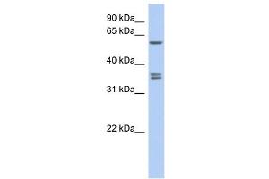 SLC19A3 antibody used at 1 ug/ml to detect target protein.