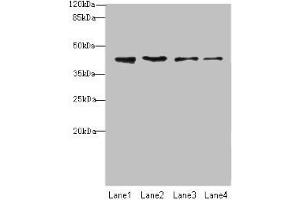 Western blot All lanes: NUP43 antibody at 4 μg/mL Lane 1: A431 whole cell lysate Lane 2: HL60 whole cell lysate Lane 3: THP-1 whole cell lysate Lane 4: A549 whole cell lysate Secondary Goat polyclonal to rabbit IgG at 1/10000 dilution Predicted band size: 43, 32 kDa Observed band size: 43 kDa (NUP43 抗体  (AA 1-200))