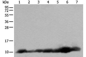Western blot analysis of 293T and RAW264. (C14orf2 抗体)