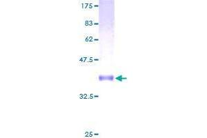 CNIH3 Protein (AA 1-160) (GST tag)