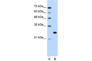 Western Blot showing FOXR2 antibody used at a concentration of 1-2 ug/ml to detect its target protein. (FOXR2 抗体  (N-Term))